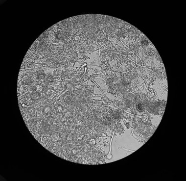 Altında mikroskobik mantarlar Aspergillus görüntüleyin. Mantar Mikrobiyoloji