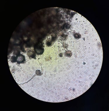 Fungi under microscopic view Aspergillus. Fungus microbiology clipart