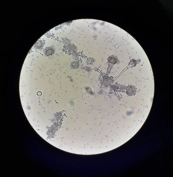 Altında mikroskobik mantarlar Aspergillus görüntüleyin. Mantar Mikrobiyoloji