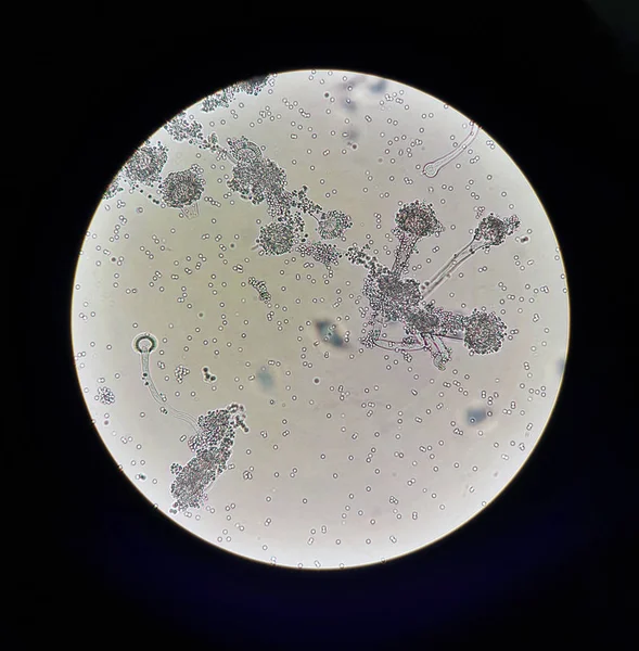 Hongos bajo vista microscópica Aspergillus. Microbiología de hongos — Foto de Stock