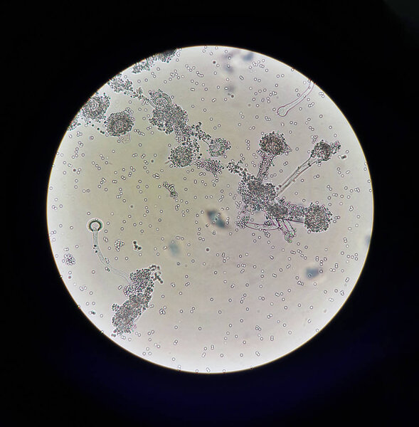 Fungi under microscopic view Aspergillus. Fungus microbiology