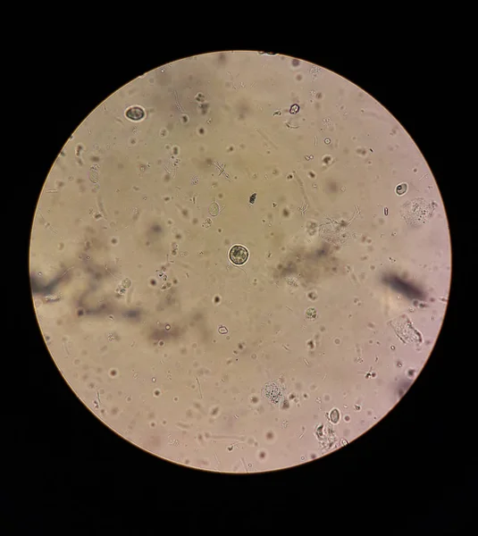 Ver en el microscopio sobre Trichomonas STD — Foto de Stock