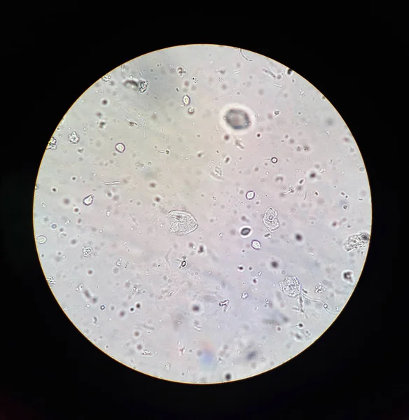 在毛滴虫标准的显微镜下观察 — 图库照片