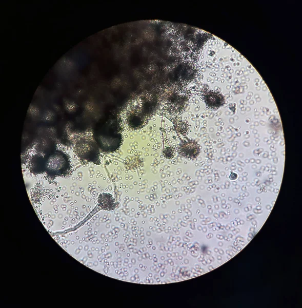 Altında mikroskobik mantarlar Aspergillus görüntüleyin. Mantar Mikrobiyoloji