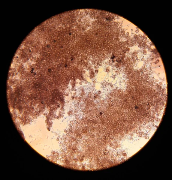 Funghi in vista microscopica Aspergillus. Microbiologia dei funghi — Foto Stock