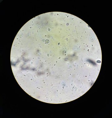 Trikomonas Std mikroskobunun otellerini göster