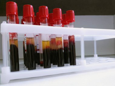 Laboratuvar testleri için kan örneği tüpler