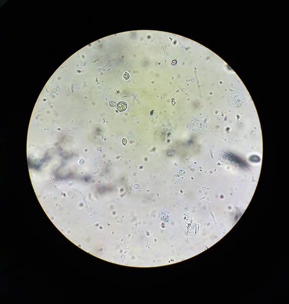 在毛滴虫标准的显微镜下观察 — 图库照片