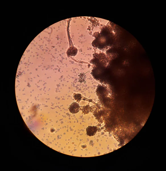 Грибы под микроскопическим обзором Aspergillus. Микробиология грибов — стоковое фото