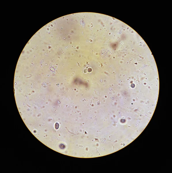 Vue au microscope sur Trichomonas STD — Photo