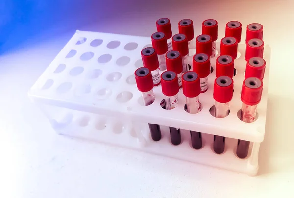 Трубки с образцом крови для лабораторного тестирования — стоковое фото