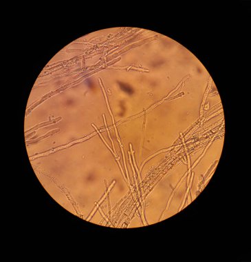 mikroskop görünüm mantarlar miselyum filamentler 40 x artış