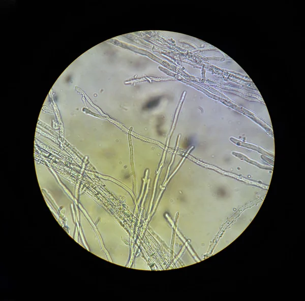 Vue au microscope des champignons mycélium filaments 40x augmentation — Photo