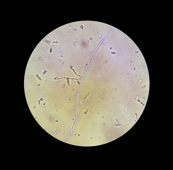 Vista del microscopio de hongos filamentos de micelio 40x aumento — Foto de Stock