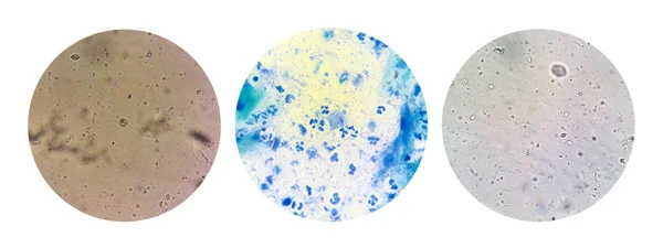 cinsel yolla bulaşan hastalık Std Trikomonas mikroskobik görüntüleme