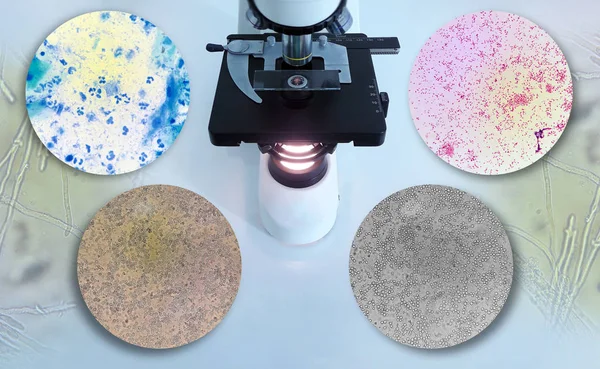 arka plandaki mikroskoptan görüntüler içeren bir mikroskop fotoğrafı