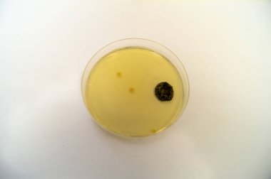 Bir Petri kabında Sabouraud agar orta üzerinde yetiştirilen küf