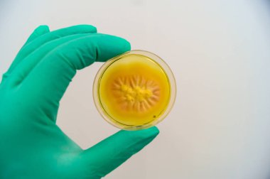 Bir Petri kabında Sabouraud agar orta üzerinde yetiştirilen küf