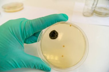 Bir Petri kabında Sabouraud agar orta üzerinde yetiştirilen küf