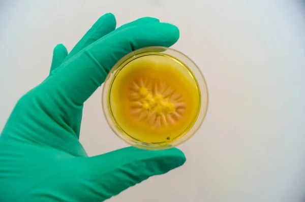 Molde cultivado en un medio agar Sabouraud en una placa Petri —  Fotos de Stock
