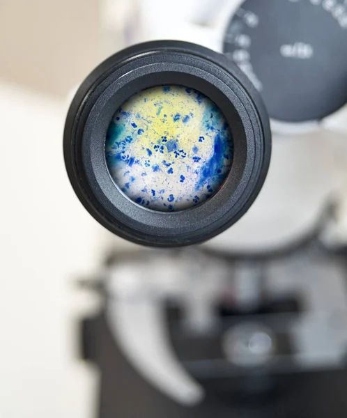 Vista en el microscopio sobre Trichomonas pintadas con azul de metileno, frotis citológico. Enfoque selectivo en el ocular . —  Fotos de Stock