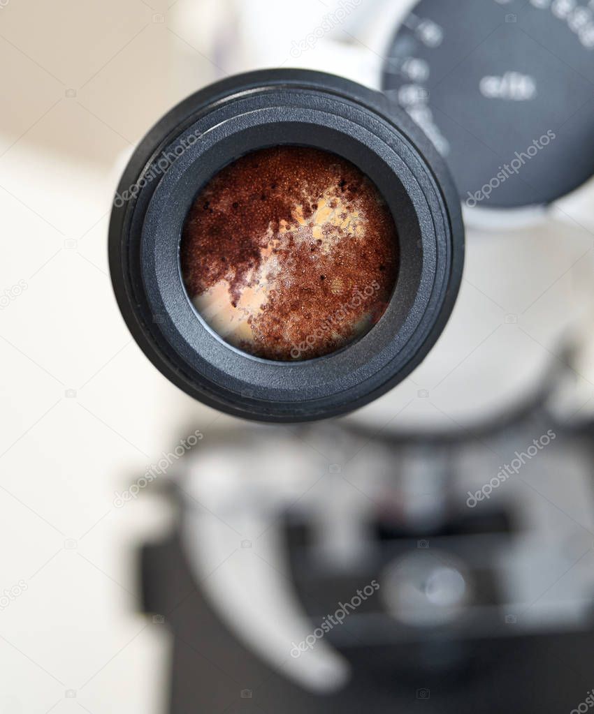 microscope view of aerobic fungi - Aspergillus niger. Selective focus on the eyepiece