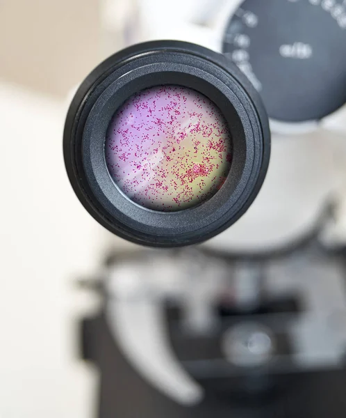 bel soğukluğu Neisseria belsoğukluğu mikroskobik görünümü. Merceye seçici odaklanma.