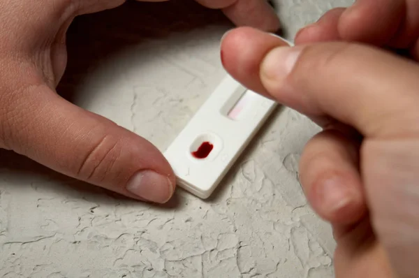 Hiv kendini test parmağı, bir damla kanla. Hiv testi ekspres.