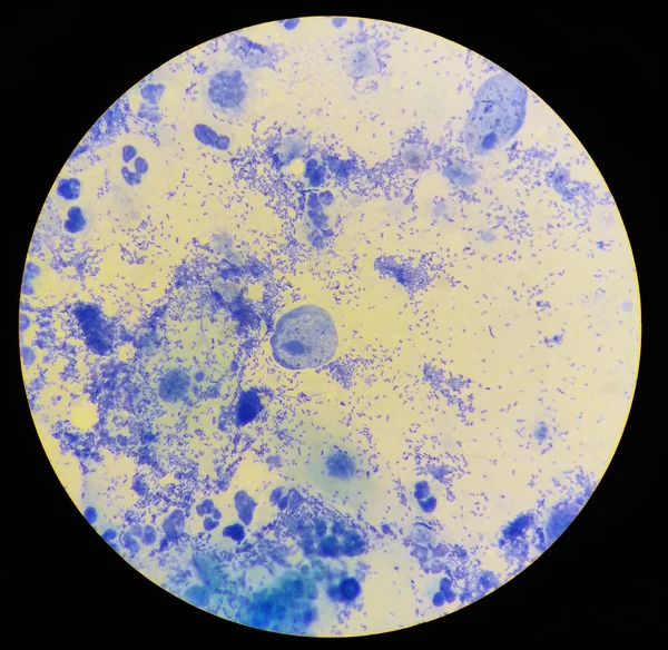 Vista en el microscopio sobre Trichomonas pintadas con azul de metileno, frotis citológico . —  Fotos de Stock