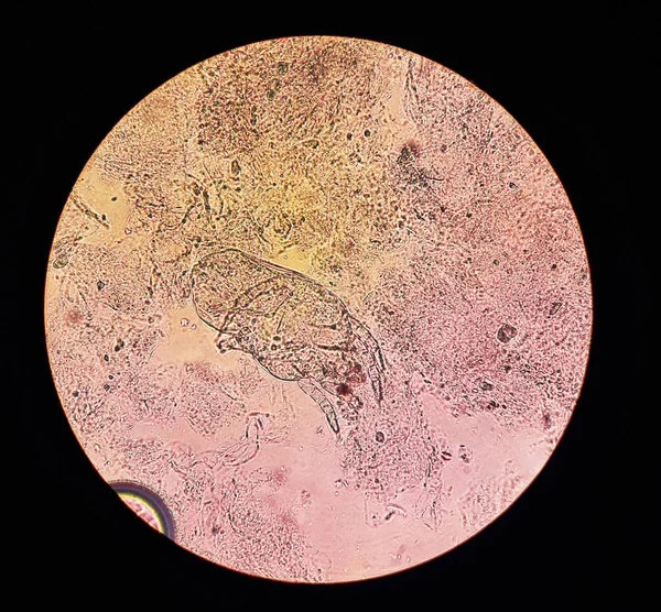 Ver no microscópio em Dermanyssus gallinae, ácaros ectoparasitas ou superficiais de aves de capoeira e outras espécies de aves — Fotografia de Stock