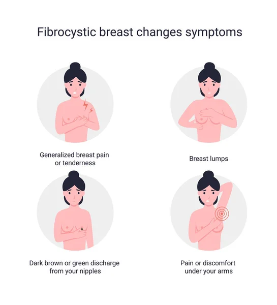 Zestaw Fibrocystic Piersi Zmienia Objawy Płaskie Wektor Kreskówka Nowoczesna Ilustracja — Wektor stockowy