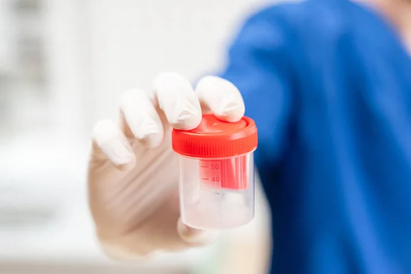 Uyuşturucu testi. Mavi üniformalı doktor ve meni analizi için bir konteynır tutan tıbbi eldivenler. Suni döllenme, kısırlık tedavisi, çocukların planlaması için donör sperm