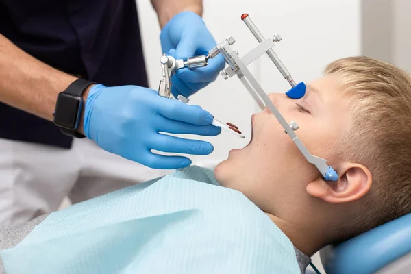 Piccolo ragazzo tenere la bocca spalancata mentre il suo dentista impostazione fino arco ortodontico — Foto Stock