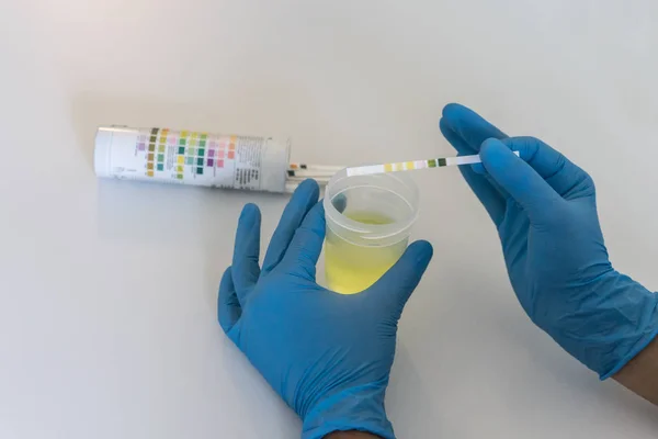 Medisch onderzoek, handen op de urinetest. Pee-test — Stockfoto