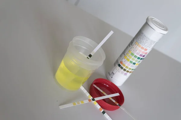 Medisch onderzoek, urinetest. Pee-test — Stockfoto