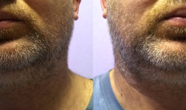 Genç bir adam yüzünde büyük değil gri anız, sol ve sağ görünümü