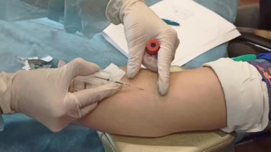 Hastanedeki bir hemşire, Coronavirus 'u yakından kontrol etmek için bir hastanın damarından kan alır. Bilimsel mikrobiyolojik test. Damarda iğne aramak gibi. Kan toplama pompası. COVID-19