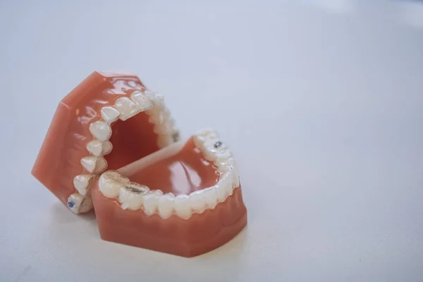 Un conjunto de prótesis dentales, clínica dental —  Fotos de Stock