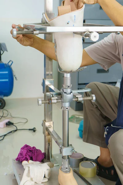 Técnico Médico Hace Una Nueva Prótesis Aluminio Piernas Para Paciente — Foto de Stock