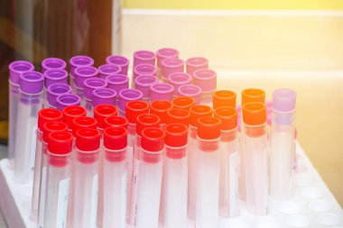 koleksiyon kan örnekleri laboratuvar Hastanesi ile tüp