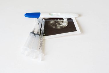 Beyaz arka planda bebek ve gebelik testi ultrason taraması