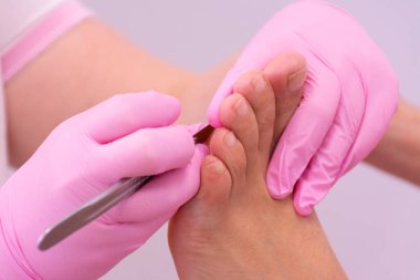 Pembe eldivenli tanınmayan bir kadın ayak hastalıkları uzmanının elleri nasırın bir ayağını neşterle kesiyor.