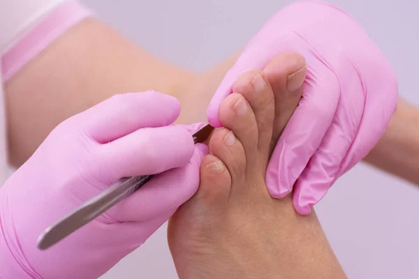 Pembe eldivenli tanınmayan bir kadın ayak hastalıkları uzmanının elleri nasırın bir ayağını neşterle kesiyor.