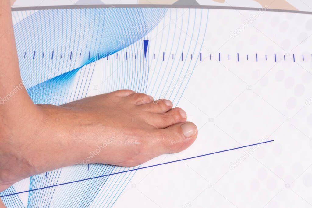 Foot of a woman on the table for the biomechanical study of the tread and position of the foot