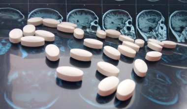 Çeşitli renkli ilaç tıp hap, kapsül ve manyetik baş ve beyin rezonans tablet arka plan tarama. Eczane Tema, sağlık, ilaç reçete tedavisi ilaç