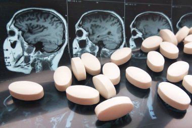 Çeşitli renkli ilaç tıp hap, kapsül ve manyetik baş ve beyin rezonans tablet arka plan tarama. Eczane Tema, sağlık, ilaç reçete tedavisi ilaç