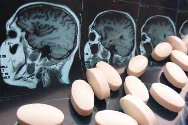 Çeşitli renkli ilaç tıp hap, kapsül ve manyetik baş ve beyin rezonans tablet arka plan tarama. Eczane Tema, sağlık, ilaç reçete tedavisi ilaç