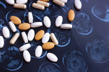 Çeşitli renkli ilaç tıp hapları ve manyetik baş ve beyin rezonans tablet arka plan tarama. Eczane Tema, sağlık, ilaç reçete tedavisi ilaç