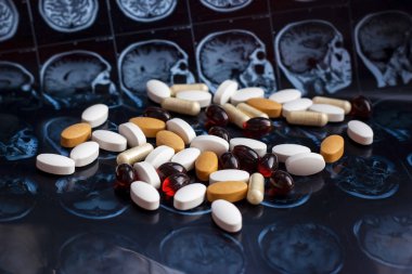 Farklı ilaç tıp hapları beyin manyetik rezonans Mr'ı arka plan tarama. Eczane Tema, sağlık, tümör, alzheimer, akıl hastalığı tedavi ilaç tedavisi için ilaç reçete