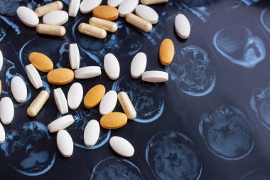 Farklı ilaç tıp hapları beyin manyetik rezonans Mr'ı arka plan tarama. Eczane Tema, sağlık, tümör, alzheimer, akıl hastalığı tedavi ilaç tedavisi için ilaç reçete